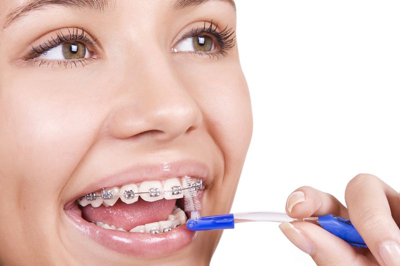 traitement orthodontique – Orthodontiste Thonon Les Bains